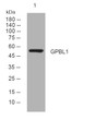 Western blot analysis of lysates from KB cells, primary antibody was diluted at 1:1000, 4°C over night
