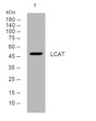 Western blot analysis of lysates from MCF-7 cells, primary antibody was diluted at 1:1000, 4° overnight STJ195174