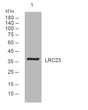 Western blot analysis of lysates from A549 cells, primary antibody was diluted at 1:1000, 4°C over night
