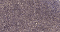 Immunohistochemical analysis of paraffin-embedded human uterus. 1, Antibody was diluted at 1:200 (4° overnight). 2, STJ195178