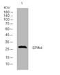 Western blot analysis of lysates from KB cells, primary antibody was diluted at 1:1000, 4°C over night