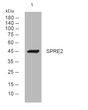 Western blot analysis of lysates from KB cells, primary antibody was diluted at 1:1000, 4°C over night