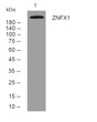 Western blot analysis of lysates from U2OS cells, primary antibody was diluted at 1:1000, 4°C over night