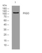 Western blot analysis of lysates from MCF-7 cells, primary antibody was diluted at 1:1000, 4°C overnight STJ195301