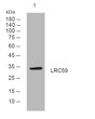 Western blot analysis of lysates from U2OS cells, primary antibody was diluted at 1:1000, 4°C overnight STJ195311