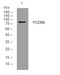 Western blot analysis of lysates from DU145 cells, primary antibody was diluted at 1:1000, 4°C overnight STJ195332