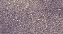 Immunohistochemical analysis of paraffin-embedded human uterus. 1, Antibody was diluted at 1:200 (4°C overnight). 2, STJ195332