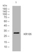 Western blot analysis of lysates from HeLa cells, primary antibody was diluted at 1:1000, 4°C overnight STJ195339