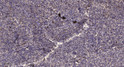 Immunohistochemical analysis of paraffin-embedded human uterus. 1, Antibody was diluted at 1:200 (4° overnight). 2, STJ195349