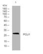Western blot analysis of lysates from HeLa cells, primary antibody was diluted at 1:1000, 4° overnight STJ195365
