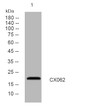 Western blot analysis of lysates from U2OS cells, primary antibody was diluted at 1:1000, 4°C over night