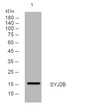 Western blot analysis of lysates from A549 cells, primary antibody was diluted at 1:1000, 4° overnight STJ195404