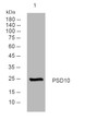 Western blot analysis of lysates from HepG2 cells, primary antibody was diluted at 1:1000, 4° overnight STJ195416