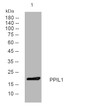 Western blot analysis of lysates from HEK293 cells, primary antibody was diluted at 1:1000, 4°C overnight STJ195441