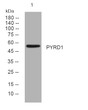 Western blot analysis of lysates from HepG2 cells, primary antibody was diluted at 1:1000, 4° overnight STJ195469