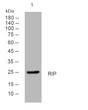 Western blot analysis of lysates from HeLa cells, primary antibody was diluted at 1:1000, 4°C overnight STJ195501