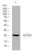Western blot analysis of lysates from DU145 cells, primary antibody was diluted at 1:1000, 4°C over night