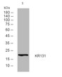 Western blot analysis of lysates from SW480 cells, primary antibody was diluted at 1:1000, 4°C overnight STJ195554
