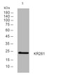 Western blot analysis of lysates from MCF-7 cells, primary antibody was diluted at 1:1000, 4° overnight STJ195611
