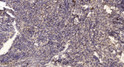 Immunohistochemical analysis of paraffin-embedded human uterus. 1, Antibody was diluted at 1:200 (4°C overnight). 2, STJ195616