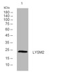 Western blot analysis of lysates from A549 cells, primary antibody was diluted at 1:1000, 4°C over night