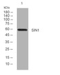 Western blot analysis of lysates from U2OS cells, primary antibody was diluted at 1:1000, 4°C overnight STJ195658