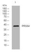 Western blot analysis of lysates from HepG2 cells, primary antibody was diluted at 1:1000, 4°C overnight STJ195667