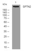 Western blot analysis of lysates from K562 cells, primary antibody was diluted at 1:1000, 4°C overnight STJ195669