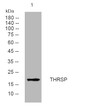 Western blot analysis of lysates from PC-12 cells, primary antibody was diluted at 1:1000, 4° overnight STJ195676