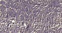 Immunohistochemical analysis of paraffin-embedded human meningioma. 1, Antibody was diluted at 1:200 (4° overnight). 2, STJ195685