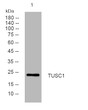 Western blot analysis of lysates from Jarkat cells, primary antibody was diluted at 1:1000, 4°C over night Western blot analysis of lysates from Jarkat cells, primary antibody was diluted at 1:1000, 4°C over night
