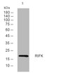Western blot analysis of lysates from U2OS cells, primary antibody was diluted at 1:1000, 4°C overnight STJ195689