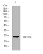 Western blot analysis of lysates from SH-SY5Y cells, primary antibody was diluted at 1:1000, 4°C overnight STJ195774