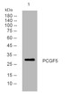 Western blot analysis of lysates from MCF-7 cells, primary antibody was diluted at 1:1000, 4° overnight STJ195790