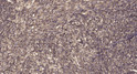 Immunohistochemical analysis of paraffin-embedded human uterus. 1, Antibody was diluted at 1:200 (4° overnight). 2, STJ195800