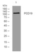 Western blot analysis of lysates from HuVEC cells, primary antibody was diluted at 1:1000, 4°C overnight STJ195811