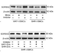 miR-21-3p in extracellular vesicles from vascular fibroblasts of spontaneously hypertensive rats promotes proliferation STJ195823