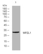 Western blot analysis of lysates from CACO2 cells, primary antibody was diluted at 1:1000, 4°C overnight STJ195924