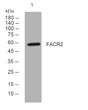 Western blot analysis of lysates from MCF-7 cells, primary antibody was diluted at 1:1000, 4°C over night