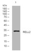 Western blot analysis of lysates from MCF-7 cells, primary antibody was diluted at 1:1000, 4°C overnight STJ195945