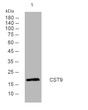 Western blot analysis of lysates from U2OS cells, primary antibody was diluted at 1:1000, 4°C over night