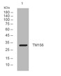 Western blot analysis of lysates from THP-1 cells, primary antibody was diluted at 1:1000, 4° overnight STJ195994