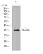 Western blot analysis of lysates from MDA-MB cells, primary antibody was diluted at 1:1000, 4° overnight STJ196009