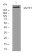 Western blot analysis of lysates from MCF-7 cells, primary antibody was diluted at 1:1000, 4°C overnight STJ196011