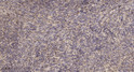 Immunohistochemical analysis of paraffin-embedded human uterus. 1, Antibody was diluted at 1:200 (4° overnight). 2, STJ196013