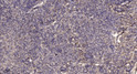 Immunohistochemical analysis of paraffin-embedded human uterus. 1, Antibody was diluted at 1:200 (4° overnight). 2, STJ196107