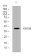 Western blot analysis of lysates from MCF-7 cells, primary antibody was diluted at 1:1000, 4°C overnight STJ196111