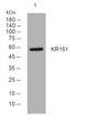 Western blot analysis of lysates from HEK293 cells, primary antibody was diluted at 1:1000, 4°C overnight STJ196112