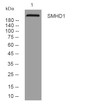 Western blot analysis of lysates from MCF-7 cells, primary antibody was diluted at 1:1000, 4°C overnight STJ196126