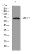 Western blot analysis of lysates from HepG2 cells, primary antibody was diluted at 1:1000, 4°C overnight STJ196129